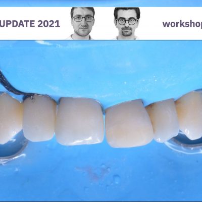 Izolarea cu diga pentru incepatori si tratamentele preendodontice. Invata rapid si aplica eficient (partener Terra Dent) (februarie 2021)