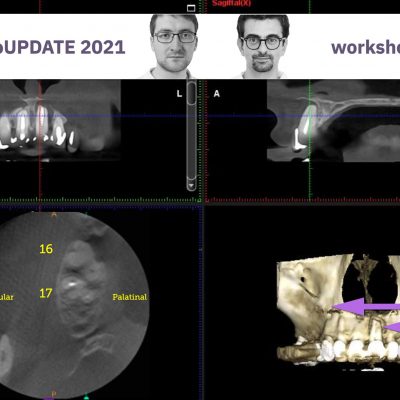 Navigarea imagistica CBCT si diagnosticul endodontie (partener DigiRay) (februarie 2021)