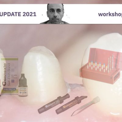 Restaurarea dintilor tratati endodontic. De la interior la exterior (februarie 2021)