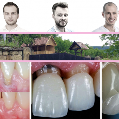 Pink & White. Camp de paro protetica (iulie 2022)