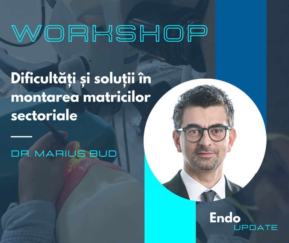 Dificultati si solutii in montarea matricilor sectoriale (Endo Update – feb. 2023)