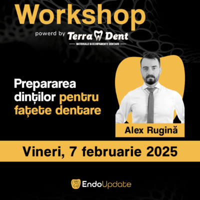Prepararea Dintilor pentru Fațete Dentare (Workshop EndoUPDATE Cluj-Napoca – feb. 2025)