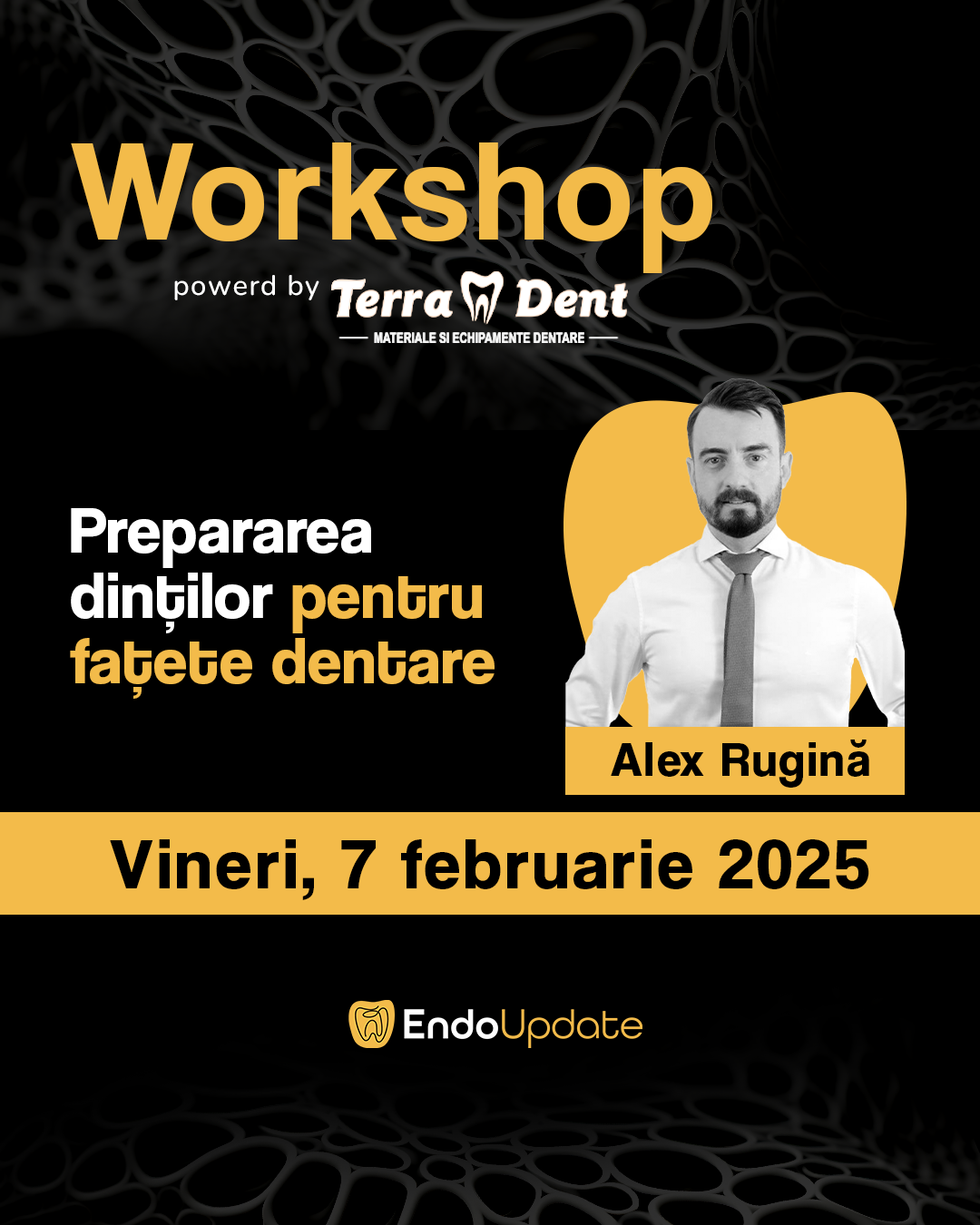 Prepararea Dintilor pentru Fațete Dentare (Workshop EndoUPDATE Cluj-Napoca – feb. 2025)