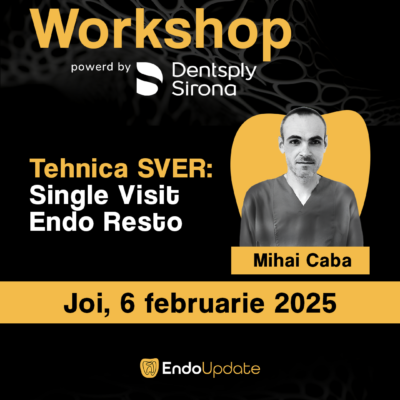 Tehnica SVER: Single Visit Endo Resto (Workshop EndoUPDATE Cluj-Napoca – feb. 2025)
