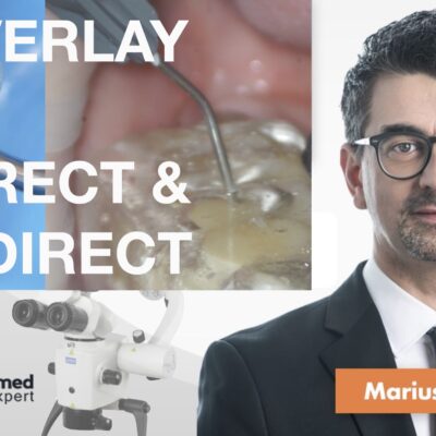 Overlay Direct & Indirect (noiembrie 2025)